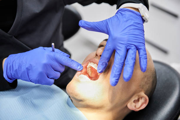 Best Broken or Cracked Tooth Emergency Dentist in Harmony Grove, CA